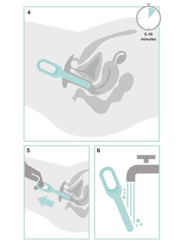 Lovehoney Health Silicone Dilator Set
